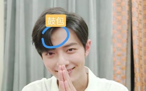 肖战疑似被私生撞到头 右侧额头有鼓包